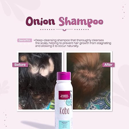 Le Shampoing Kaba – extrait d'oignon rouge, stimulation potentielle du cuir chevelu.