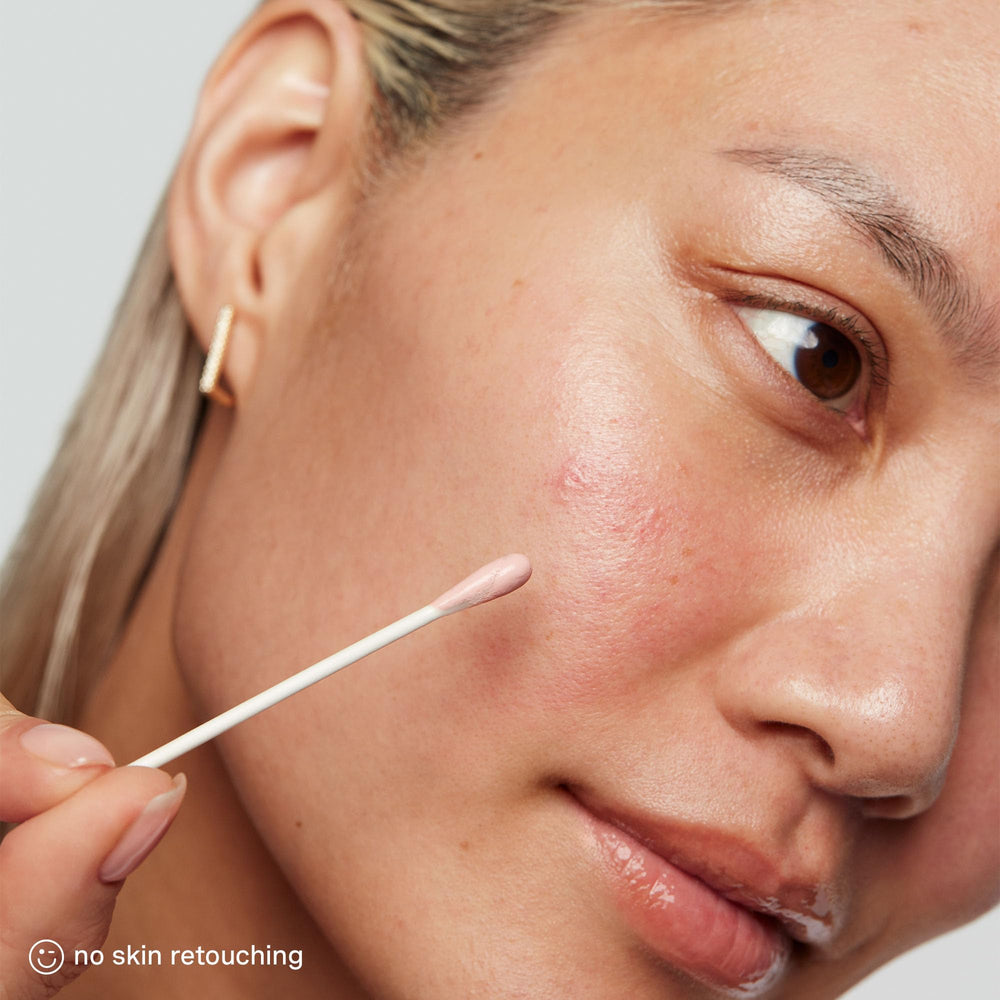 Avant-après EradiKate montrant amélioration clinique sur la peau