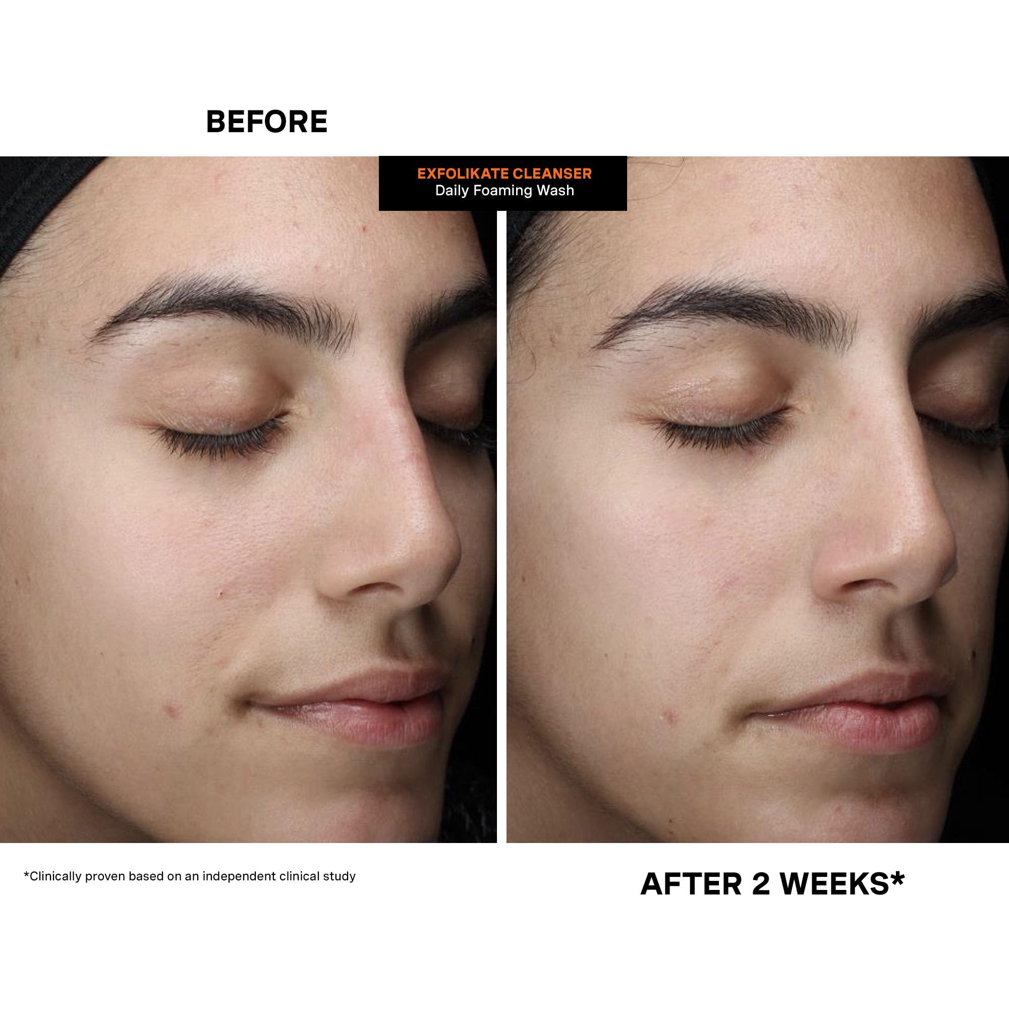 Kate Somerville ExfoliKate: routine quotidienne adaptée à tous types de peau.