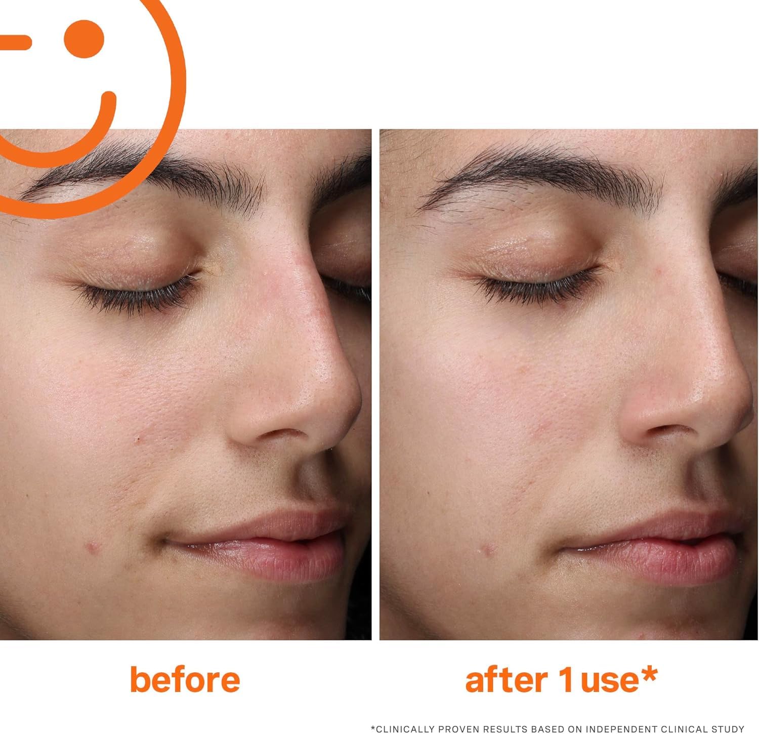 Kate Somerville ExfoliKate, routine matin et soir simplifiée pour une peau purifiée
