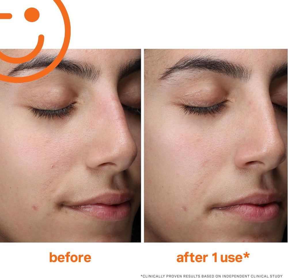 Kate Somerville ExfoliKate, routine matin et soir simplifiée pour une peau purifiée
