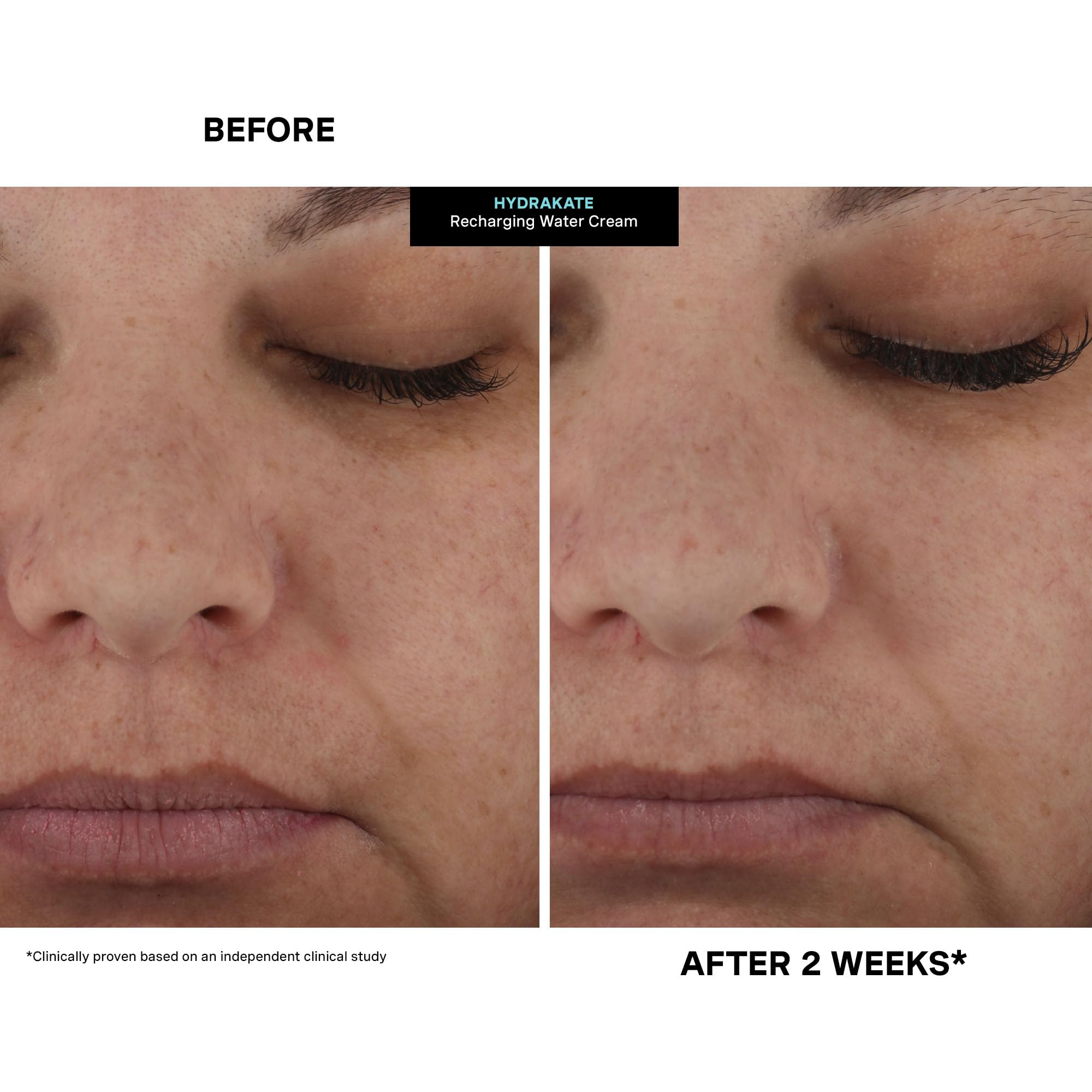 Kate Somerville HydraKate – peau éclat après application, effet lumineux.