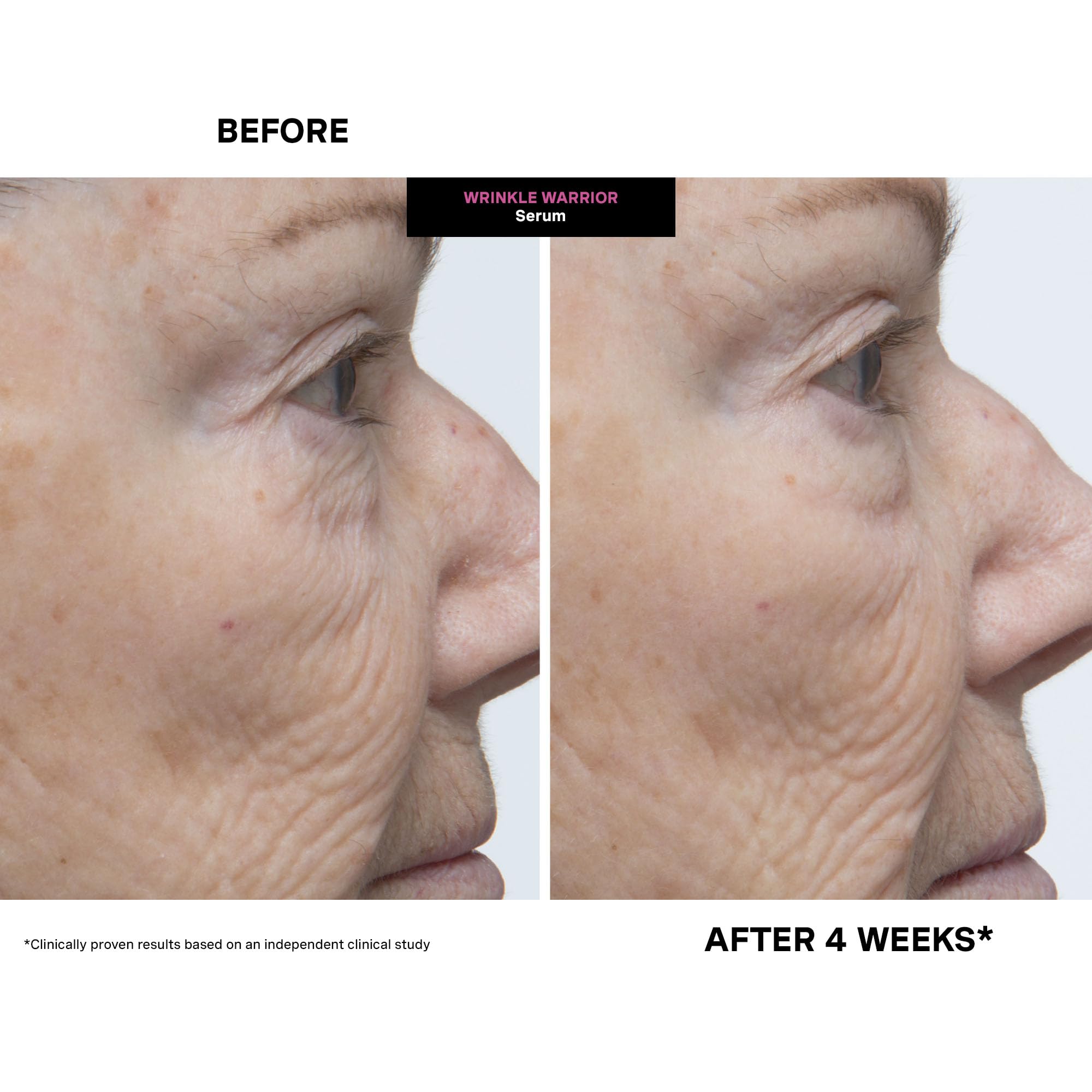 Kate Somerville Wrinkle Warrior, brillance-apparente: teint frais et lumineux.