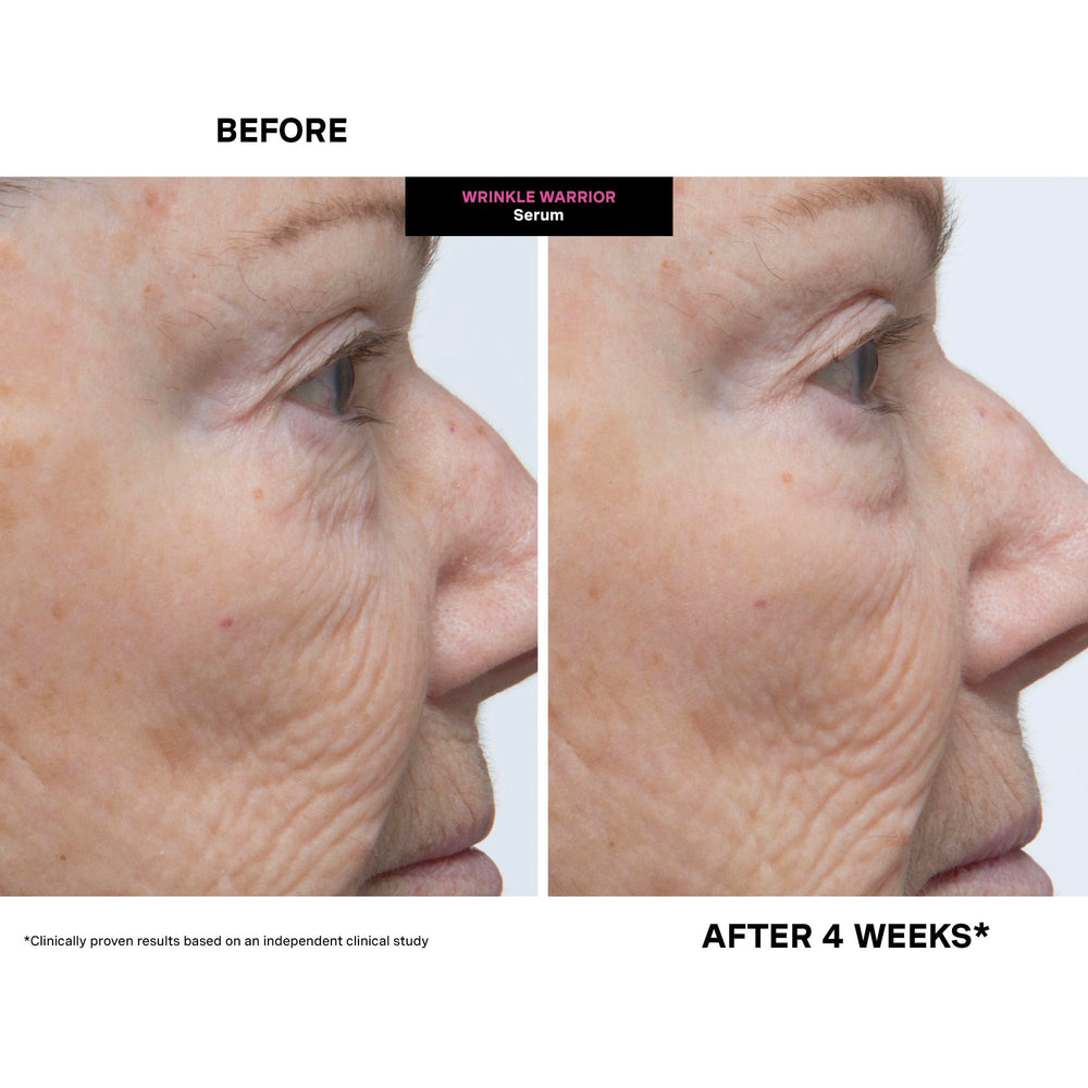 Kate Somerville Wrinkle Warrior, brillance-apparente: teint frais et lumineux.