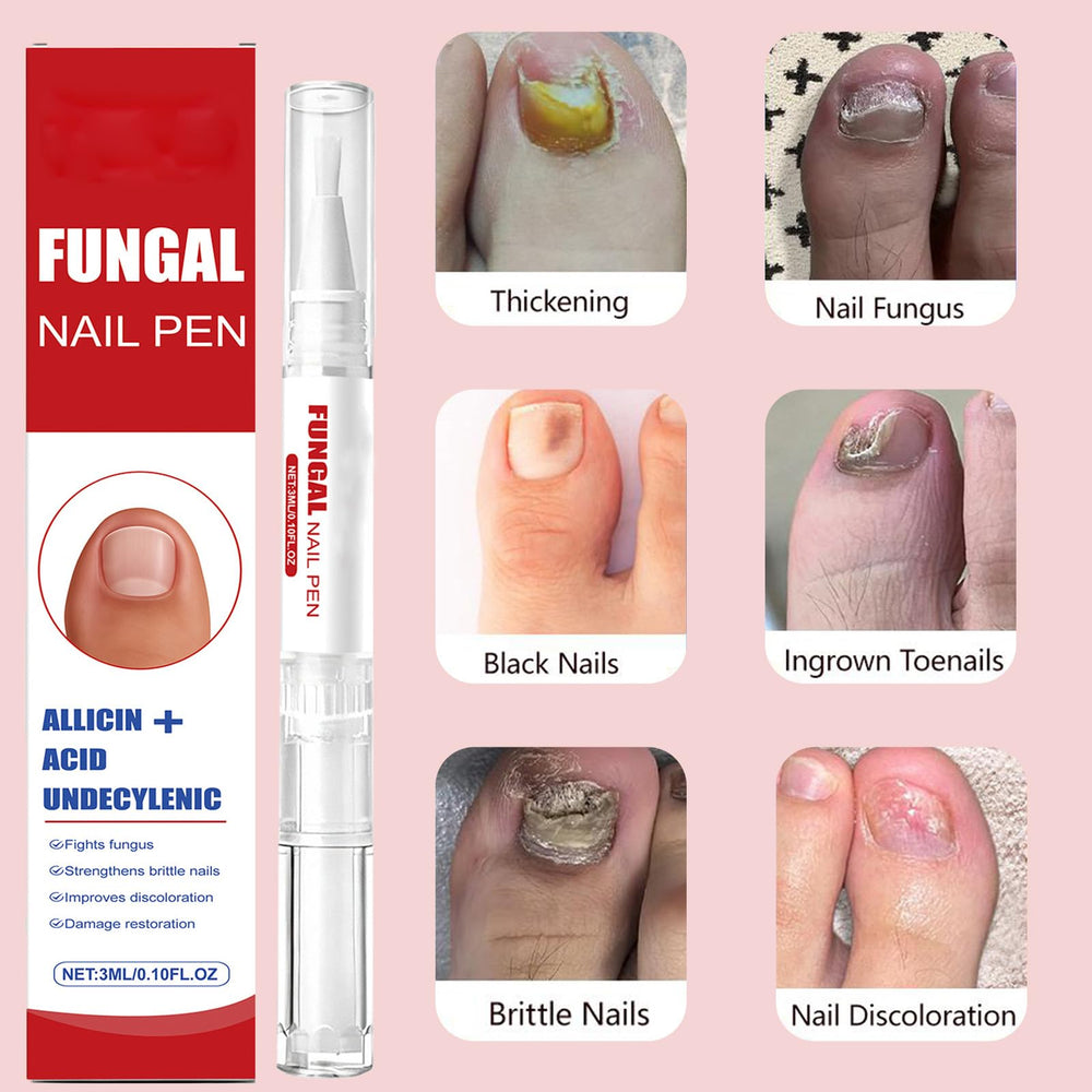 KBSBUBB Utilisation adaptée pour ongles des doigts et des orteils.