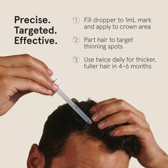Keeps Minoxidil: application-homme, routine simple et pratique pour les hommes.