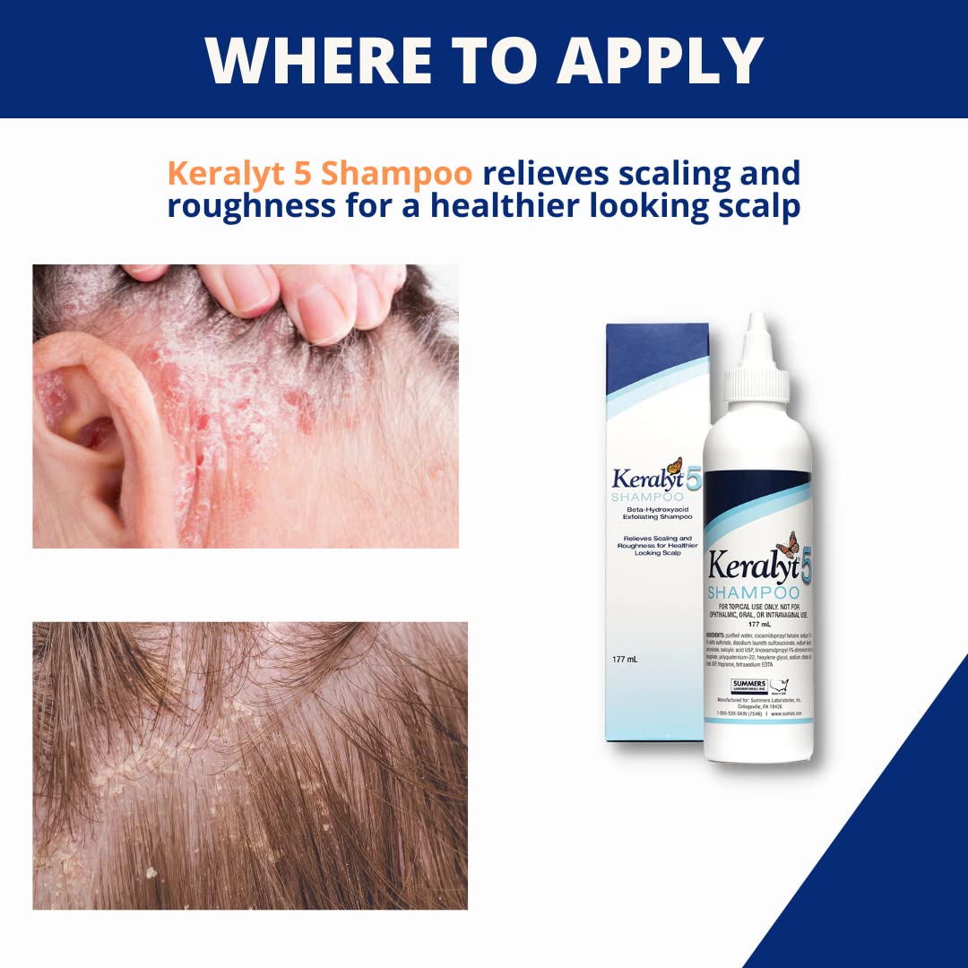 Keralyt 5 Shampoing, texture crème, sensation douce lors de l'application