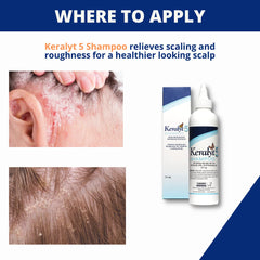 Keralyt 5 Shampoing, texture crème, sensation douce lors de l'application