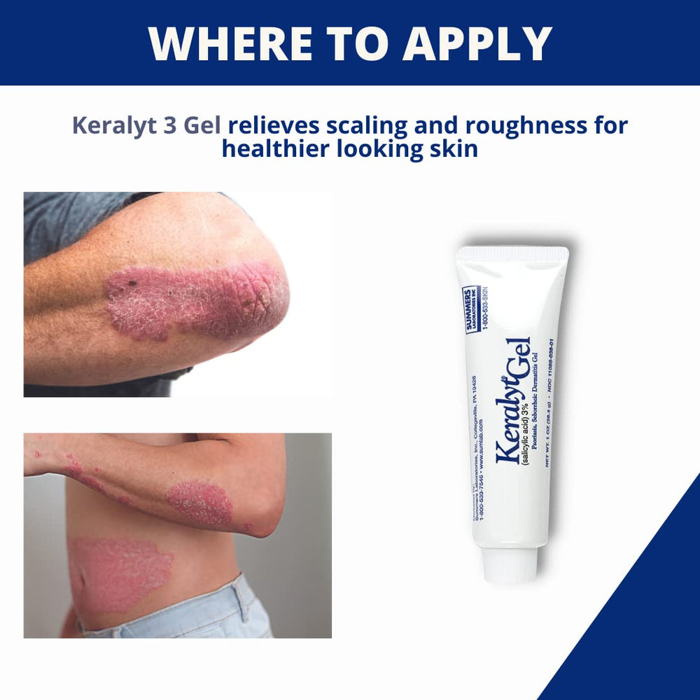 Keralyt Gel 3% - emballage compact et pratique pour le transport.