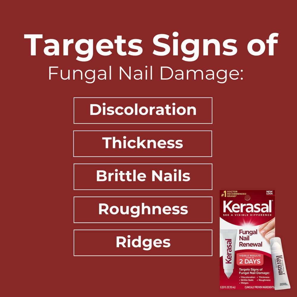 Kerasal Ongles Avant-Après: aperçu clair de l'apparence des ongles.