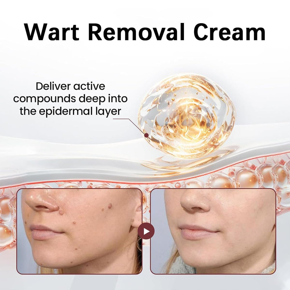 KeraErase Crème de renouvellement — texture crème prête pour l'hydratation.