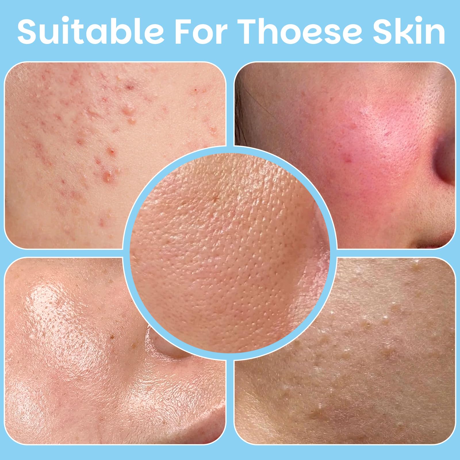 Texture peau plus équilibrée après utilisation des pads Kestper