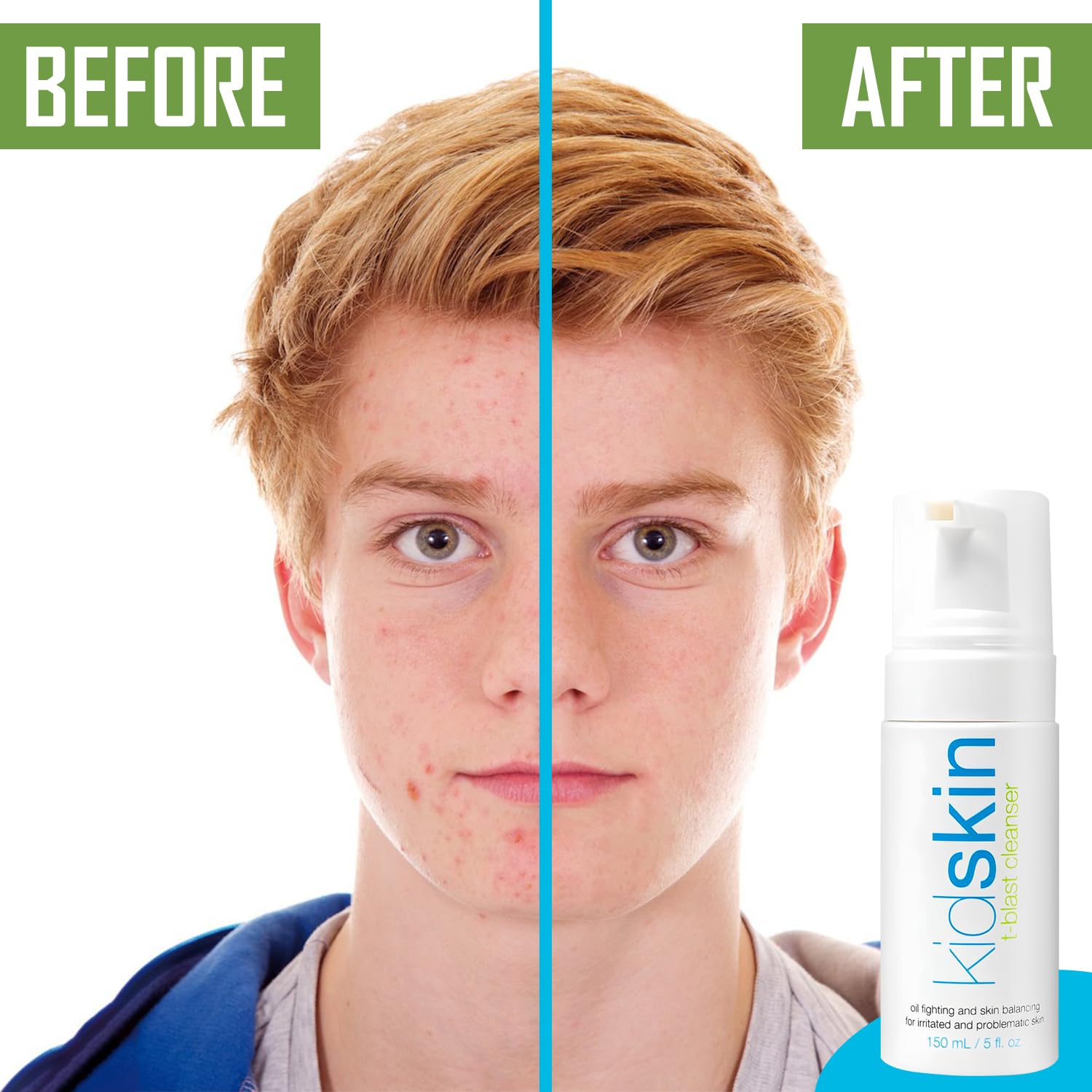 Kidskin T-Blast: formule sans parfum ni additifs agressifs.