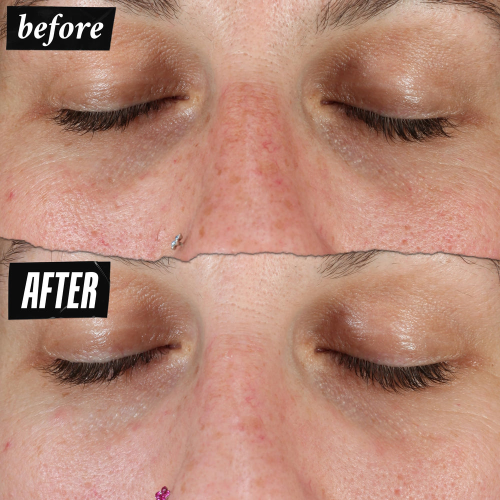 Sérum Clearly Corrective avec acide salicylique tamponné favorisant peau nette