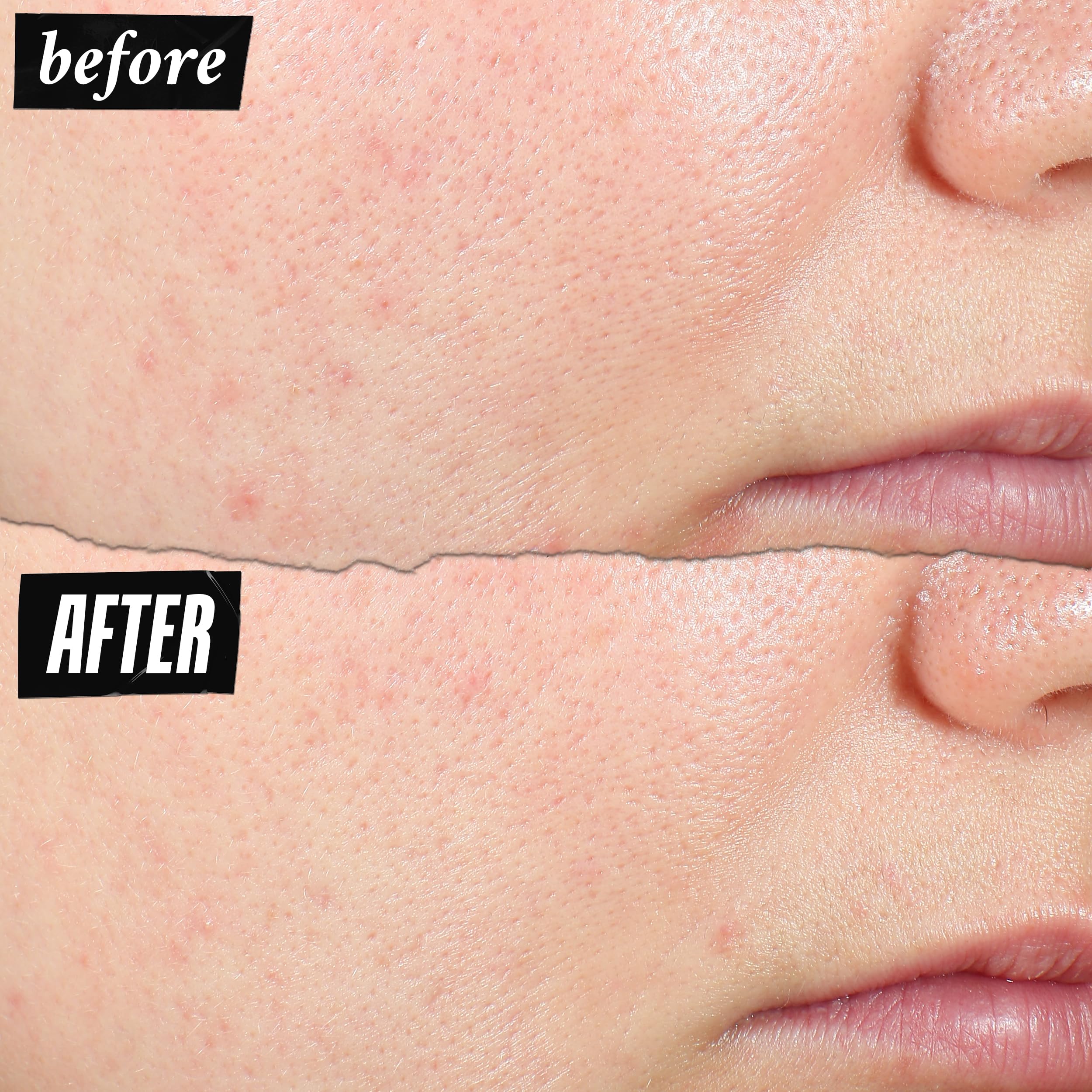 Kiehl's Expertly Clear améliore la texture et éclaircit les zones inégales