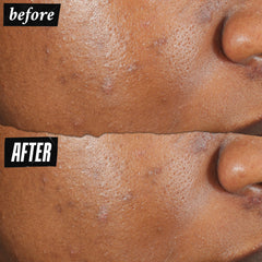 Texture liquide du pansement Kiehl's sur peau sensible