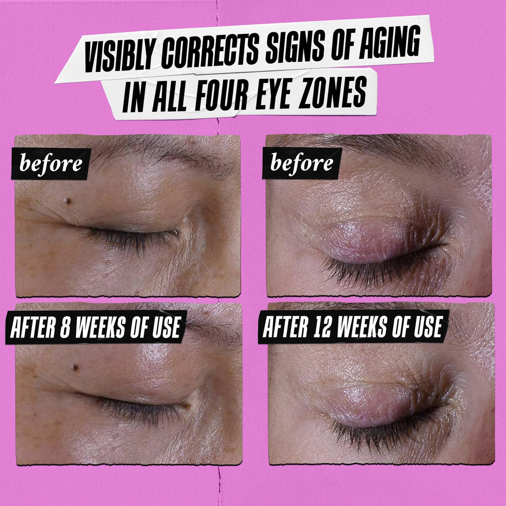 Kiehl's Super Multi-Corrective Eye Cream décongestionne les poches et apporte fraîcheur