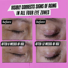 Kiehl's Super Multi-Corrective Eye Cream décongestionne les poches et apporte fraîcheur