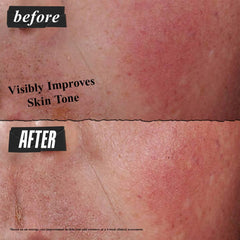 Kiehl's Ultra Facial Barrier Cream – apaisement des rougeurs sur peau sensible.