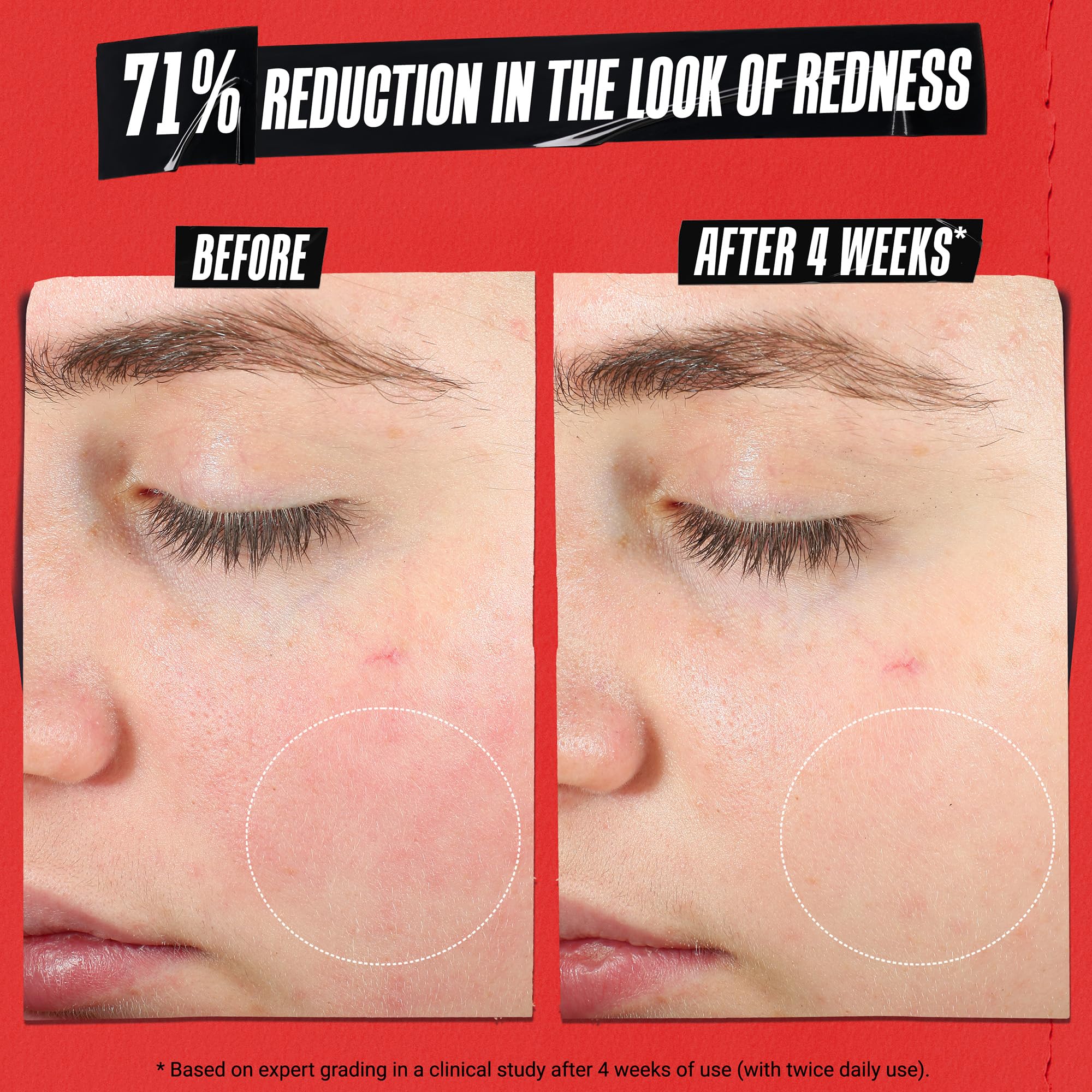 Kiehl's Ultra Facial Recovery Barrier Cream – texture legere et absorption rapide.