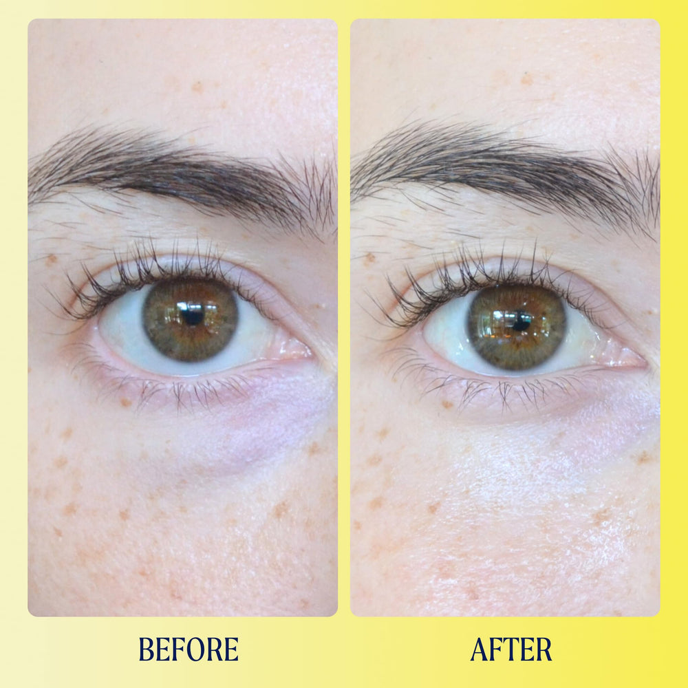 Ingrédient vitamine C ester dans Kinship Brightwave pour éclairer le contour des yeux
