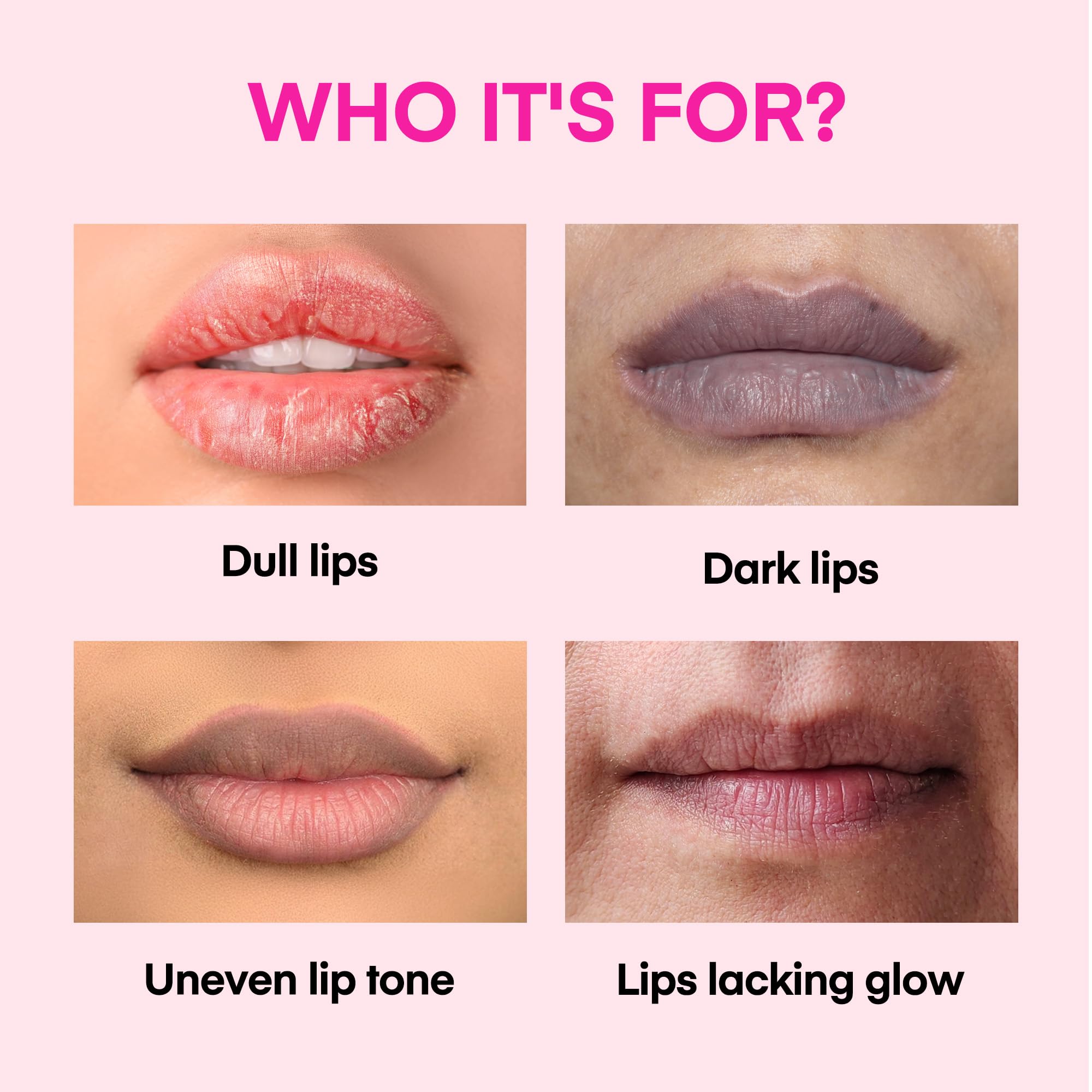 KissBea Lip Lightening – Ingrédients : vitamine C et extrait de citron.