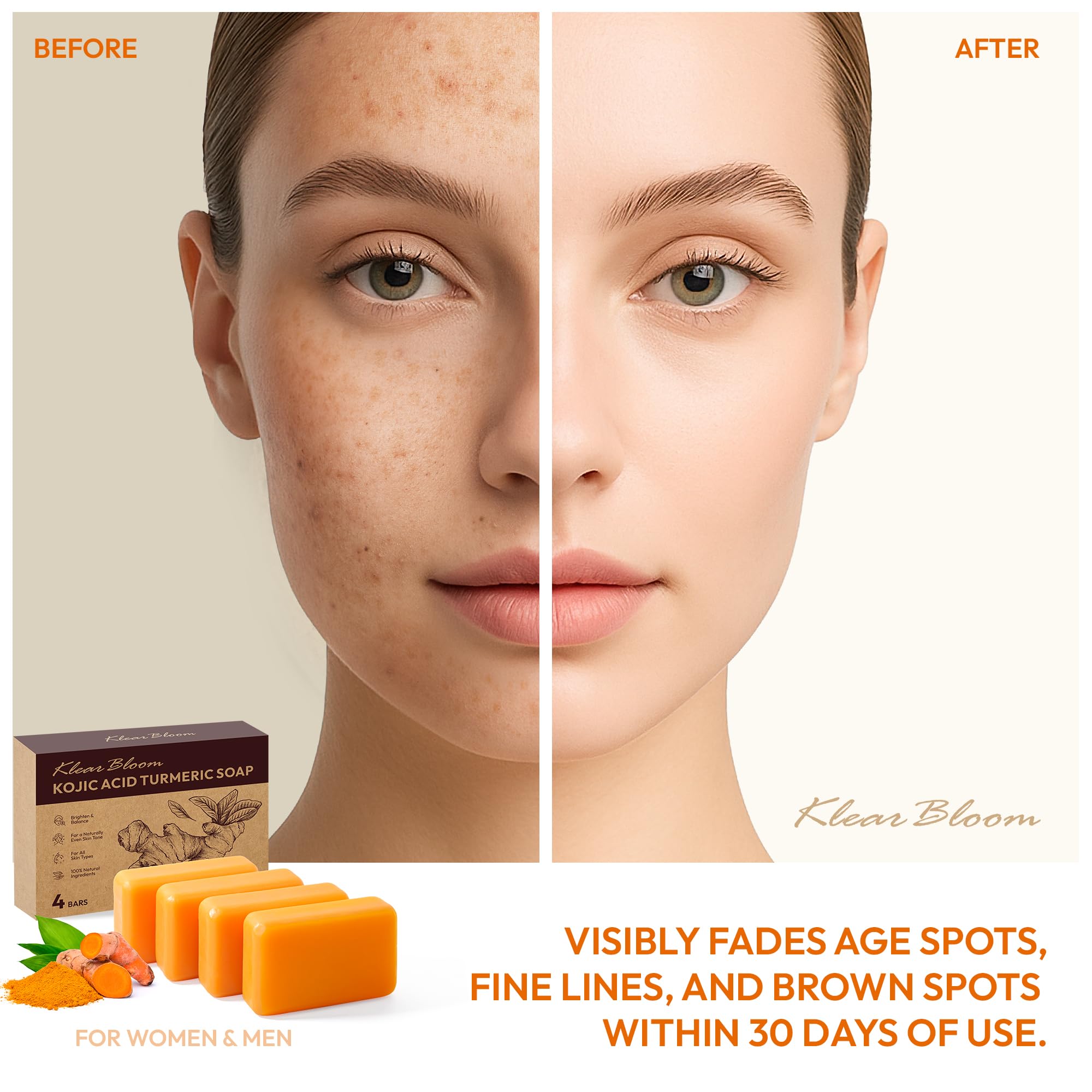 Savon acide kojique et curcuma – détail barre, texture crèmeuse et hydratante