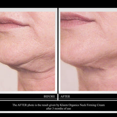 Kleem Organics crème retinol visage décolleté, application quotidienne pour routine soin.