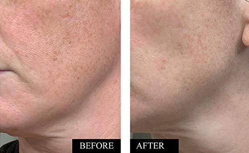 Kleem Organics sérum vitamine C, gouttes visibles et texture légère qui pénètre rapidement
