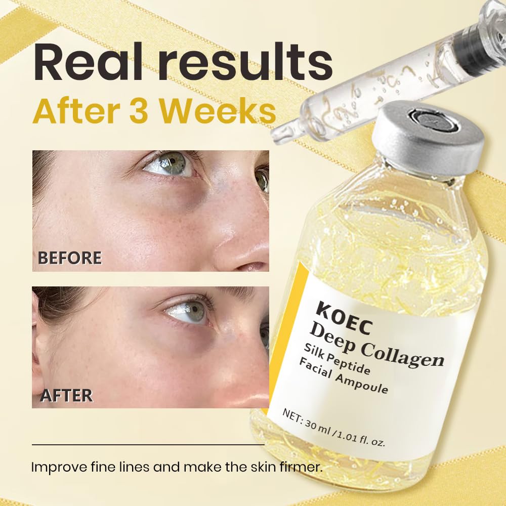 KOEC syringe application setup demonstrates precise dosage and clean use