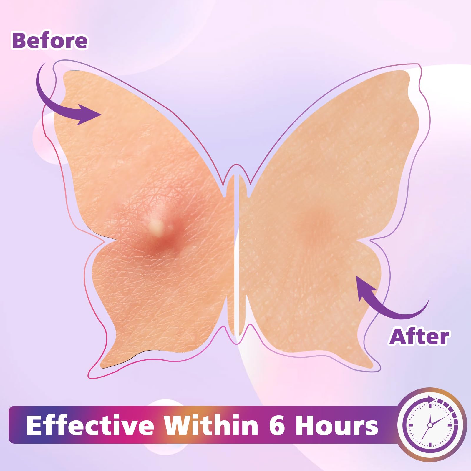 Pansement KONEUK forme papillon violet design ludique utile en voyage.