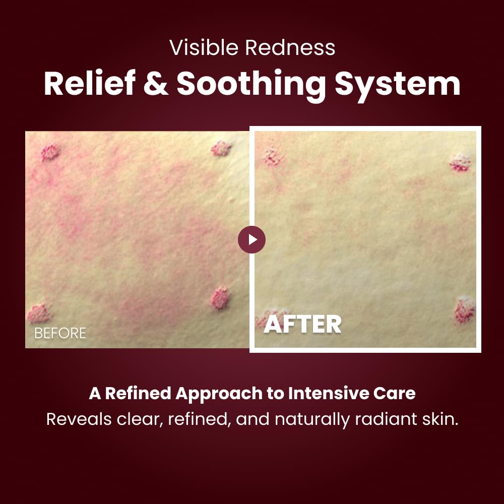 Kopher Complexe Multipeptides, soutien à la résilience cutanée et récupération.