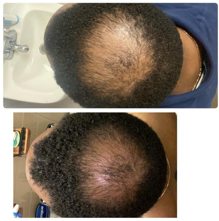 Kreyol Essence Cheveux Plus Forts Brillance – effet visuel après usage régulier.