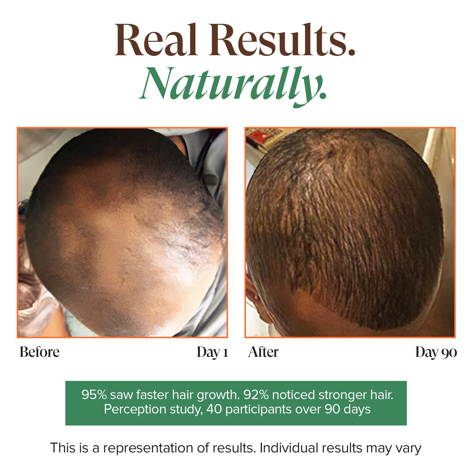 Kreyòl Essence traitement huile chaude, efficace sur cheveux secs et cassants.
