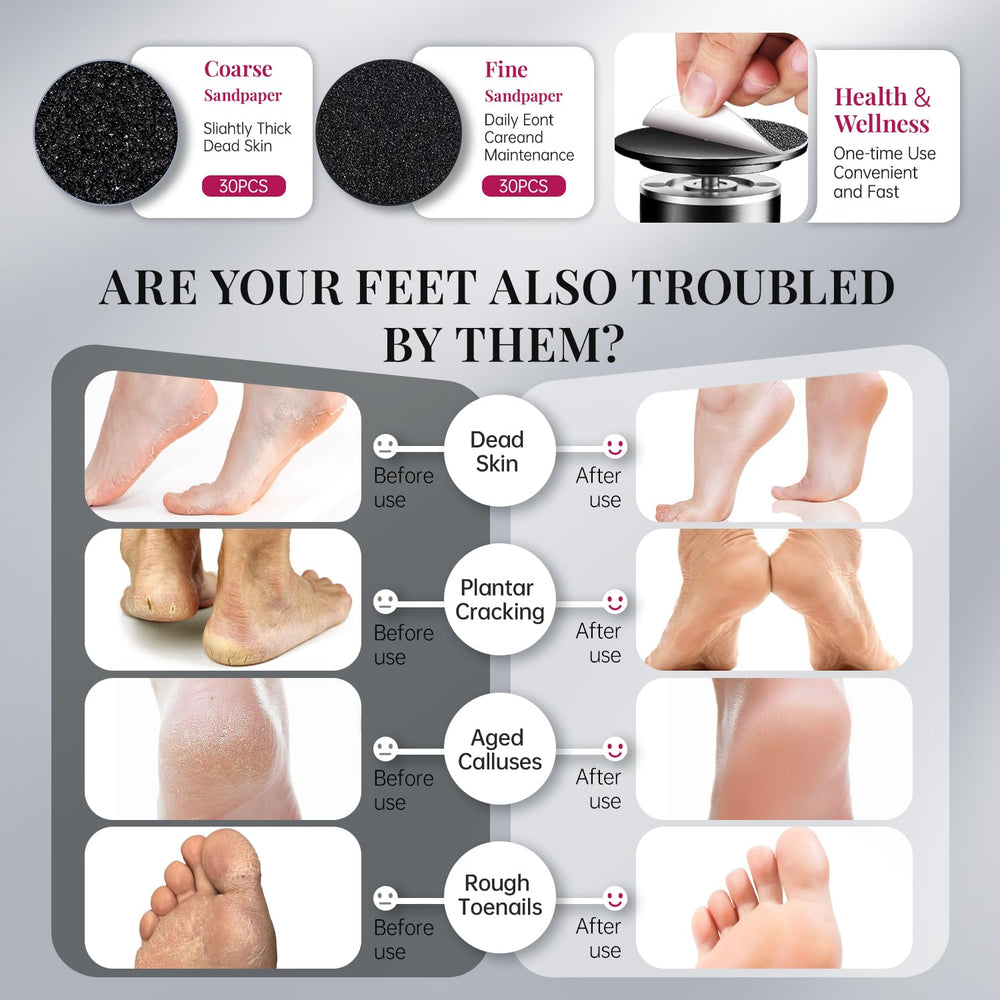 Idéal pour pieds et talons, usage quotidien Krofaue.