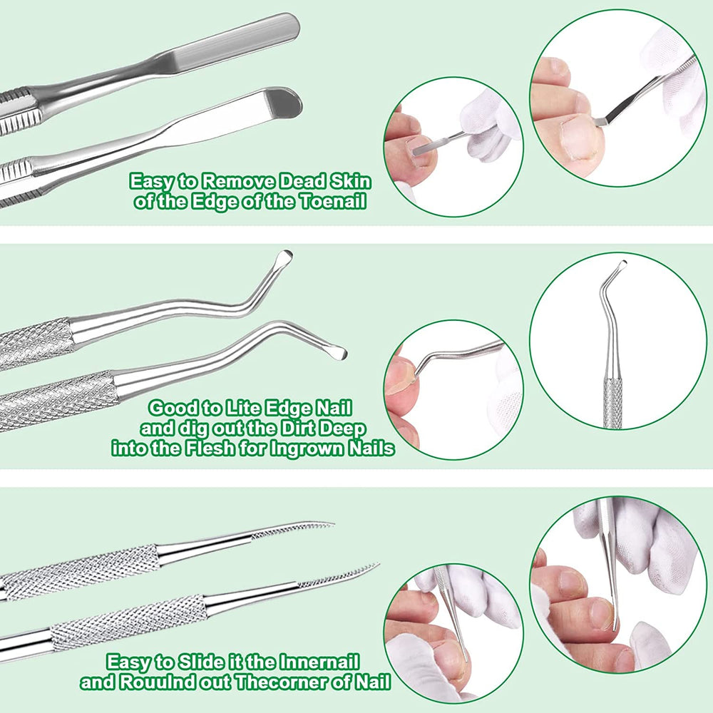 KuanStore lime à ongles incarnés et outil de correction, précision pour les ongles incarnés.