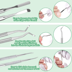 KuanStore lime à ongles incarnés et outil de correction, précision pour les ongles incarnés.