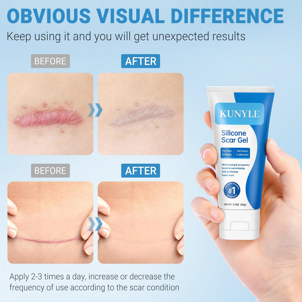 Kunyle Gel Silicone : application en massage circulaire, utilisation quotidienne possible.