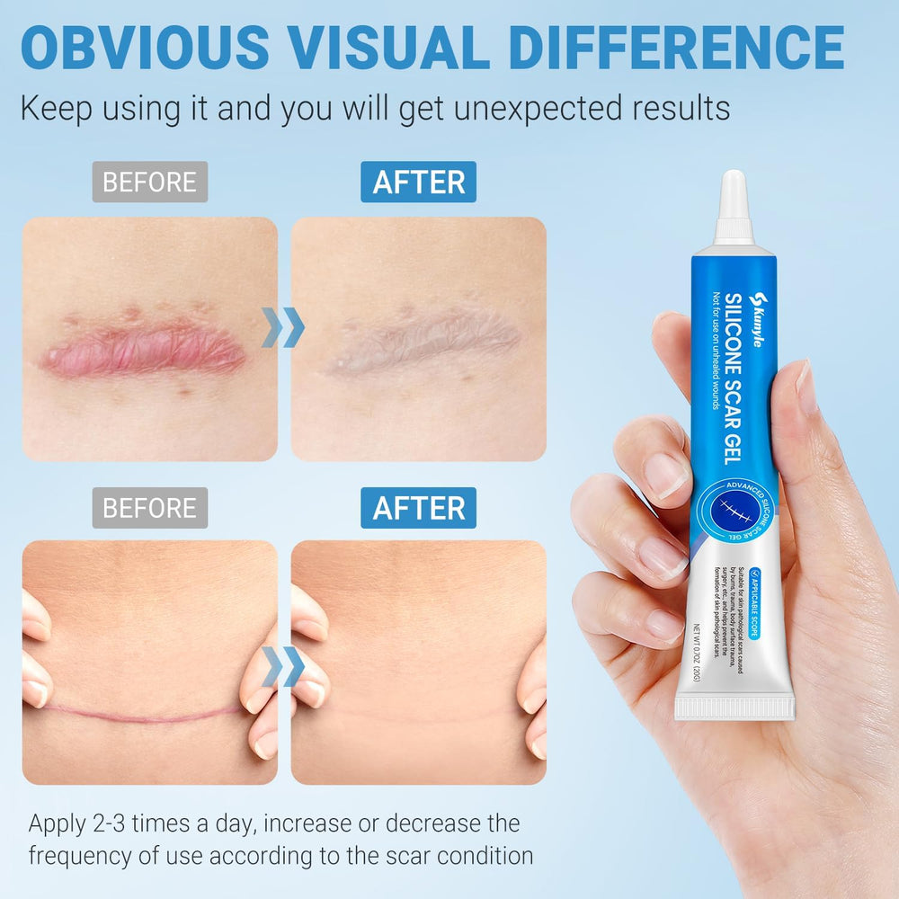 Close-up texture of Kunyle silicone scar gel for quick absorption and non-greasy feel
