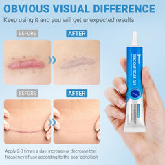 Close-up texture of Kunyle silicone scar gel for quick absorption and non-greasy feel