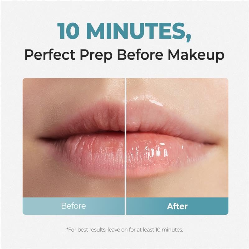 Laka Embout Gel pour une application hygiénique et précise.
