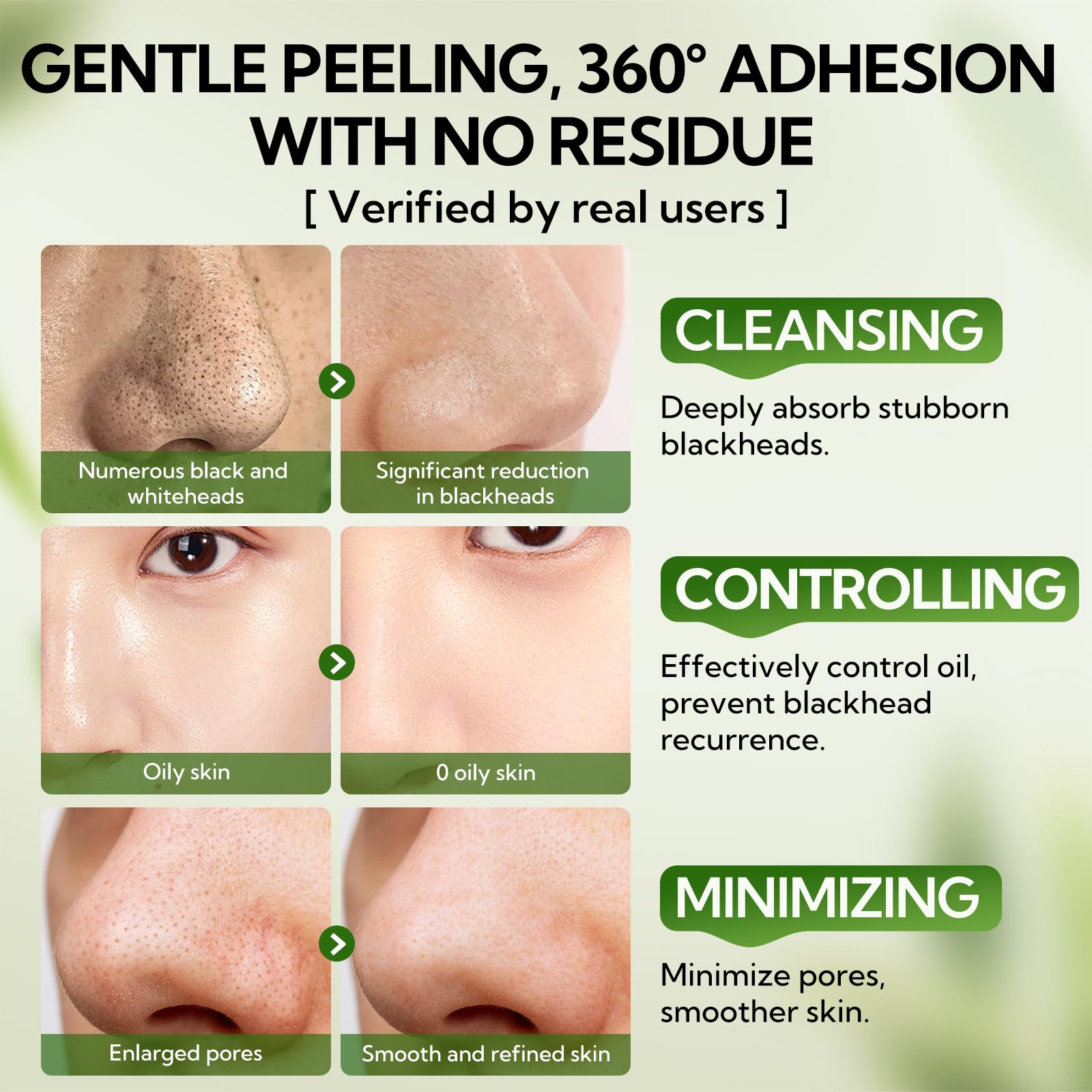 LANBENA Aloe Vera apaise la peau après le soin des pores