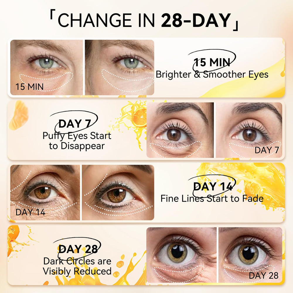 LANBENA Patchs Yeux Anti-Âge – ridules visiblement atténuées.