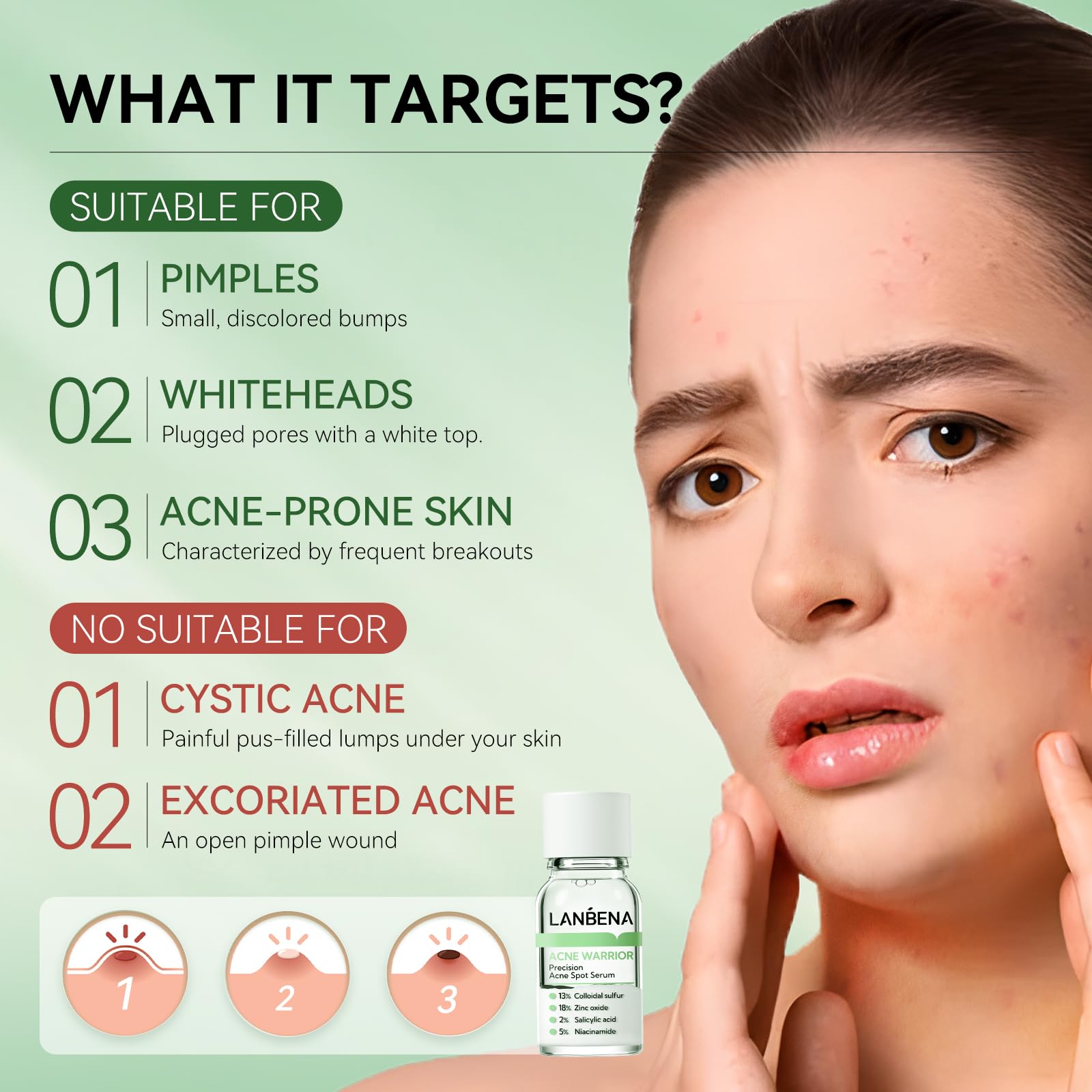 Lanbena Sérum dissout boutons et pores bouchés pour une peau claire.
