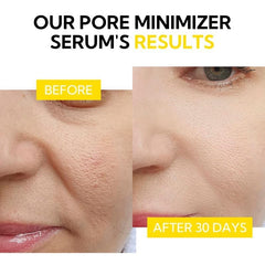 Hamamélis apaisant et pore serré, pour une texture peau plus nette.
