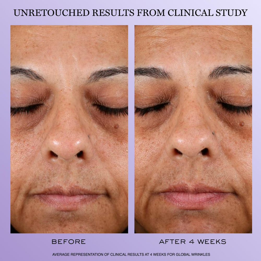 Lancôme Crème anti-age jour – flacon, effet léger et raffermissant possible.