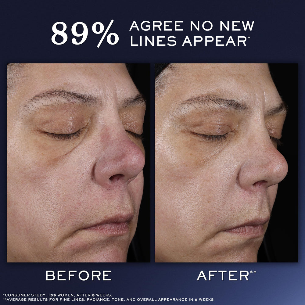 Lancôme Génifique sérum acide hyaluronique – effet repulpant et hydratant.
