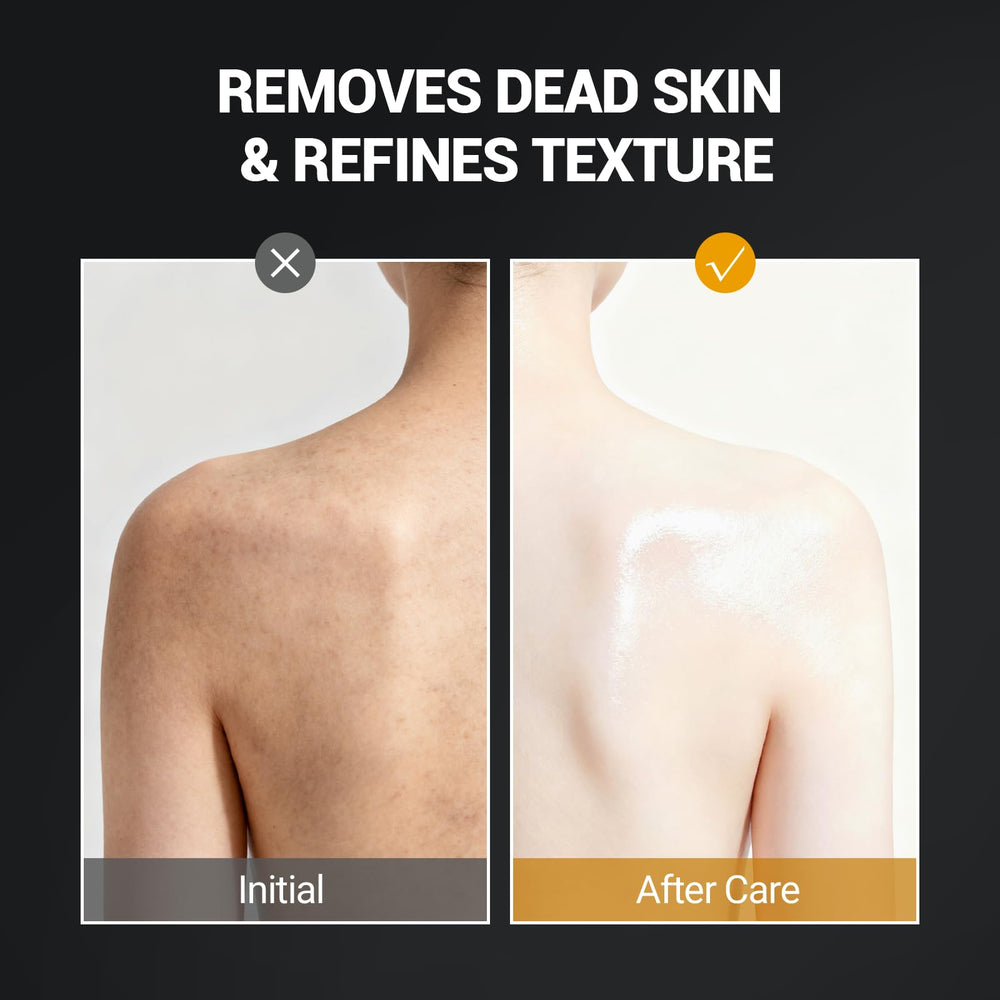 LANGULLCI visage-niacinamide-vitamine-c: teint plus lumineux et uniforme.