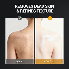 LANGULLCI visage-niacinamide-vitamine-c: teint plus lumineux et uniforme.