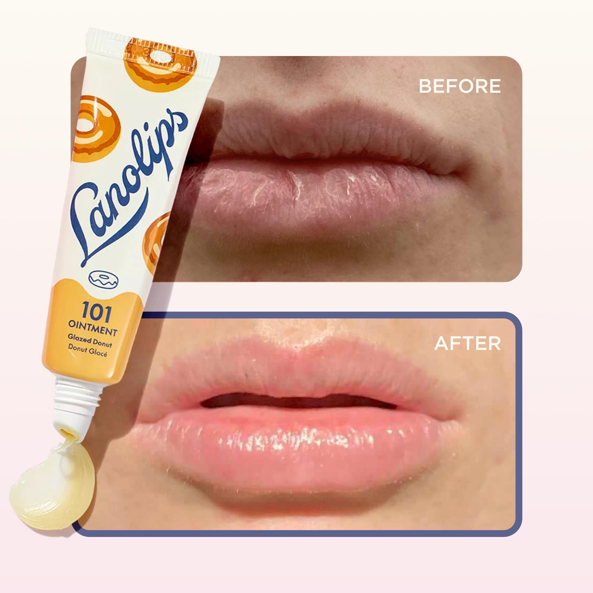 Lanolips 101 sans cruauté animale, soin doux pour les lèvres.